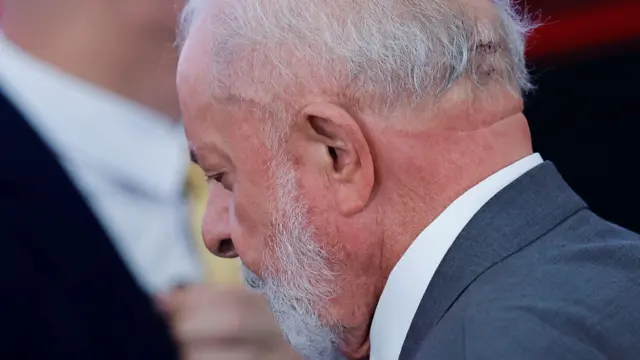 Lula se recupera bem após cirurgia emergencial na cabeça