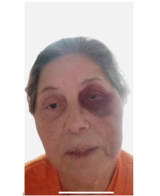 ⚖️ PGR recusa prisão domiciliar a idosa agredida após condenação pelo 8 de janeiro