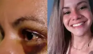 Quando a opinião vira espetáculo