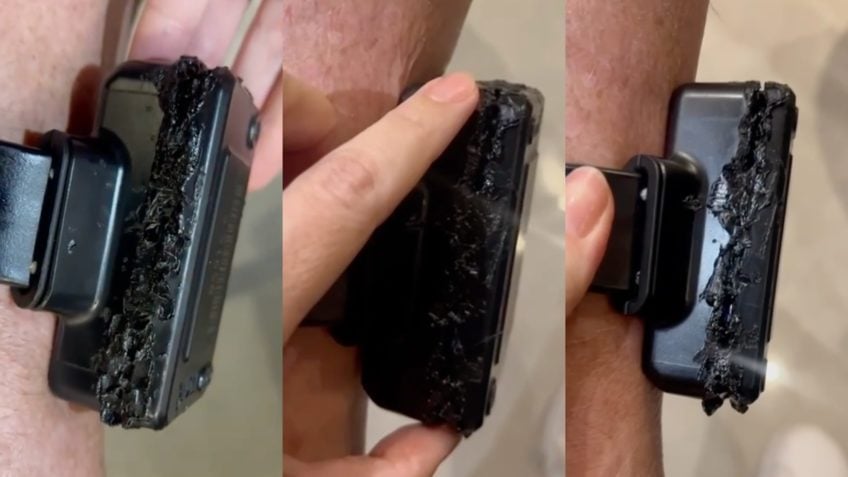 Tornozeleira queimada? Imagens revelam marcas e levantam mais dúvidas sobre prisão de Bolsonaro