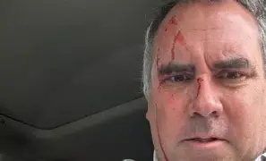 Atentado vergonhoso: Peru inicia corrida eleitoral com violência digna de repúdio nacional