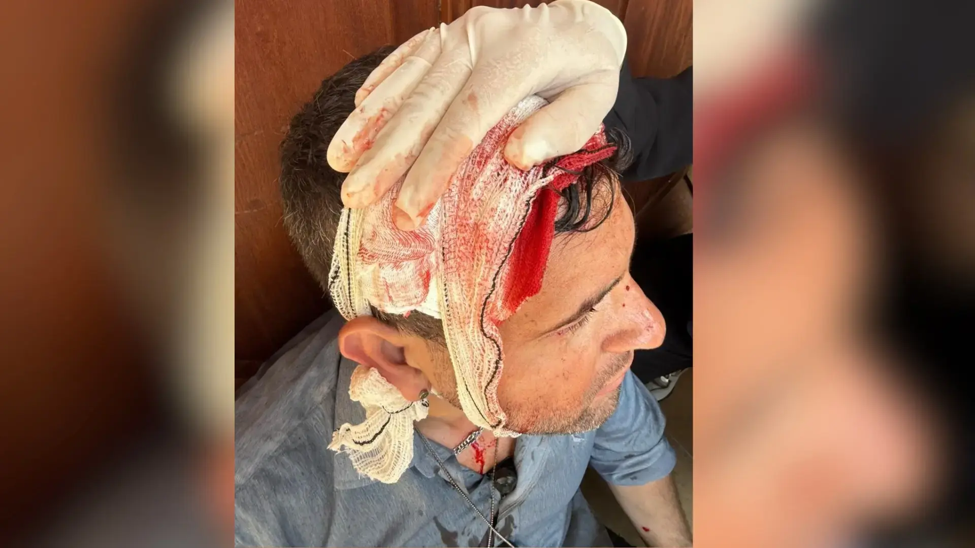 Confusão em Evento com Lula Termina com Agente do GSI Ferido no Espírito Santo Confusão em Evento com Lula Termina com Agente do GSI Ferido no Espírito Santo